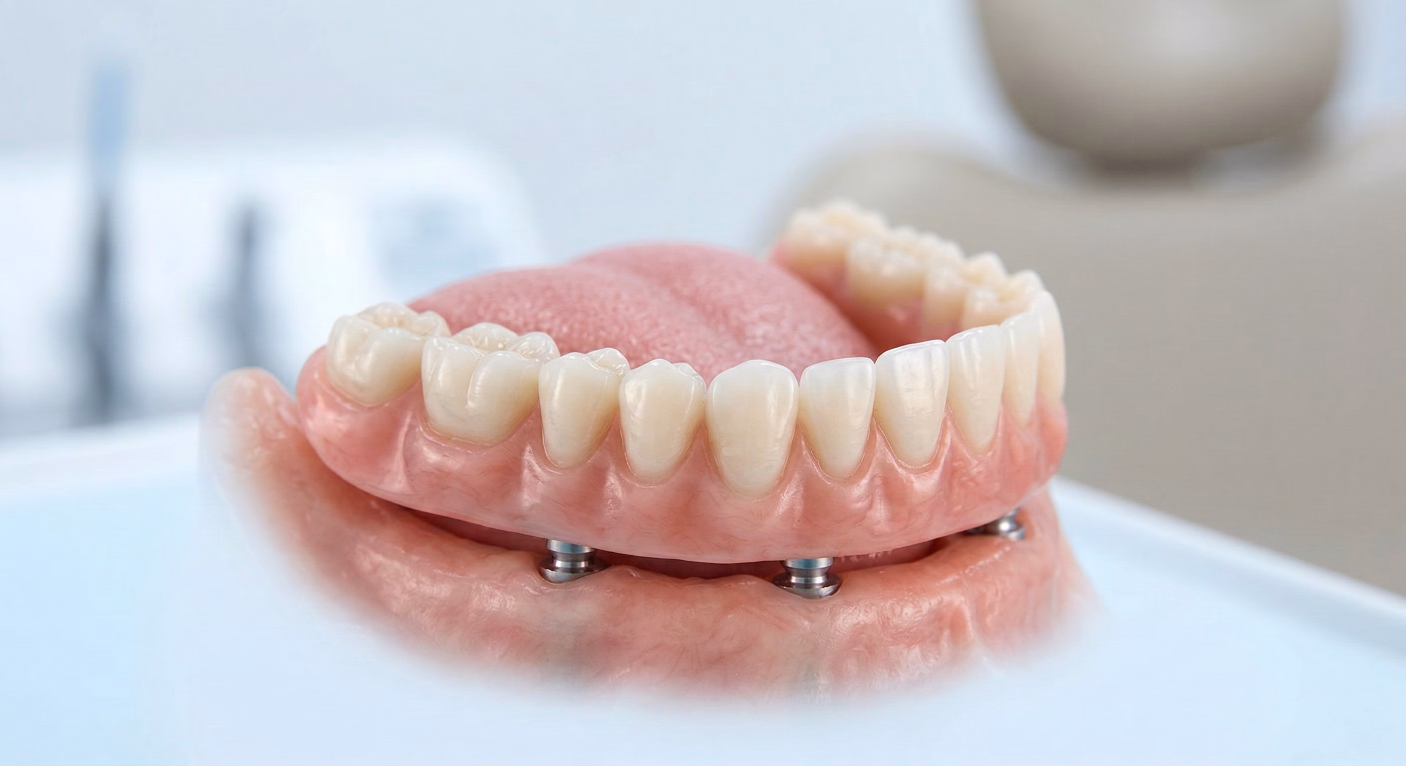 implant dentures
